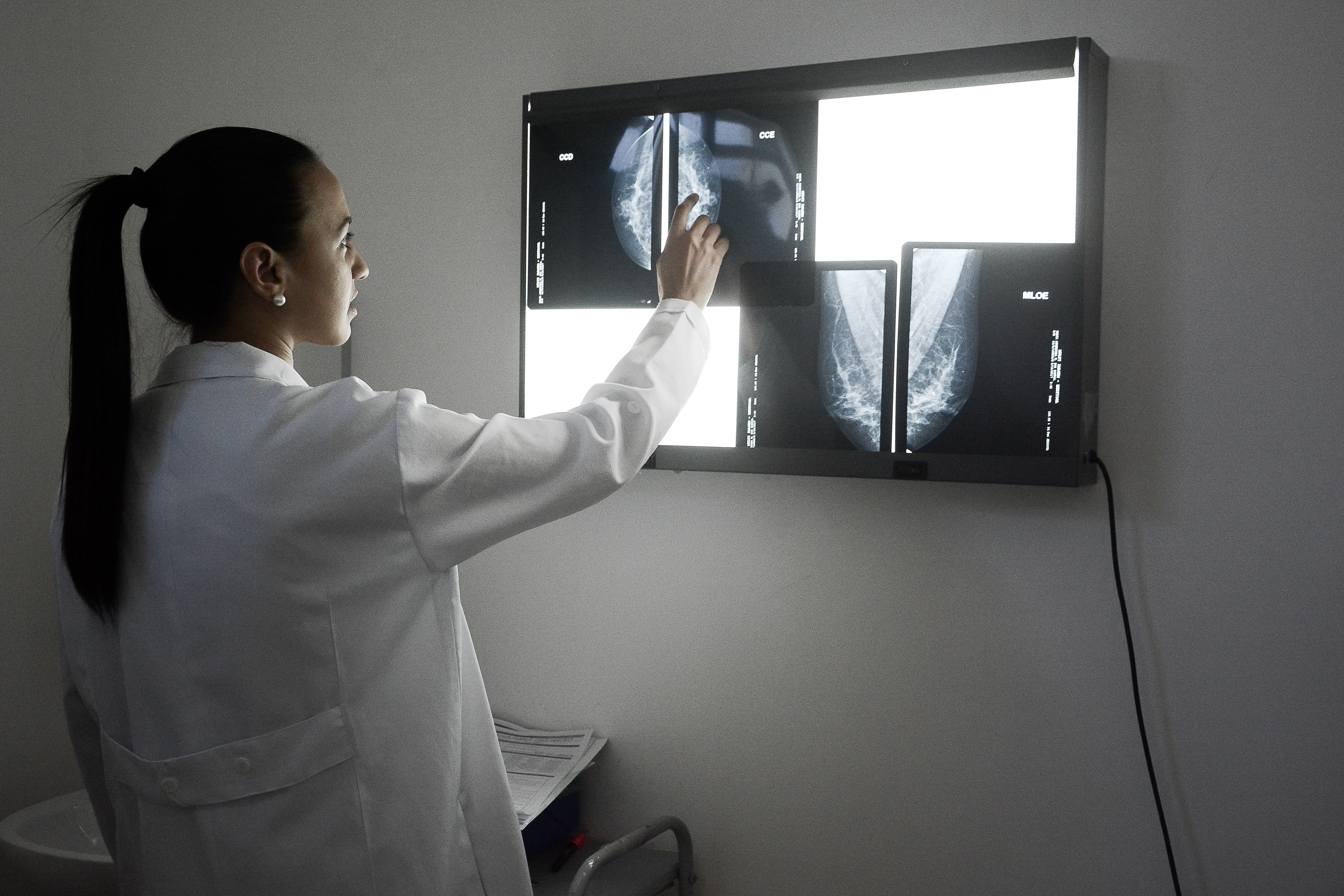 Prefeitura realiza exames de mamografia em todas as UBSs de Bertioga